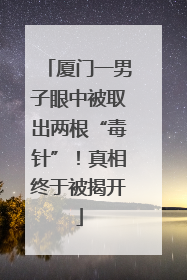 厦门一男子眼中被取出两根“毒针”！真相终于被揭开